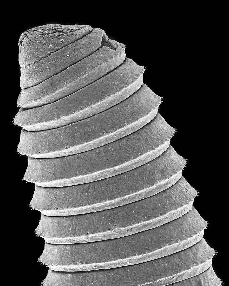 Detritus worm (Class Annelida), SEM