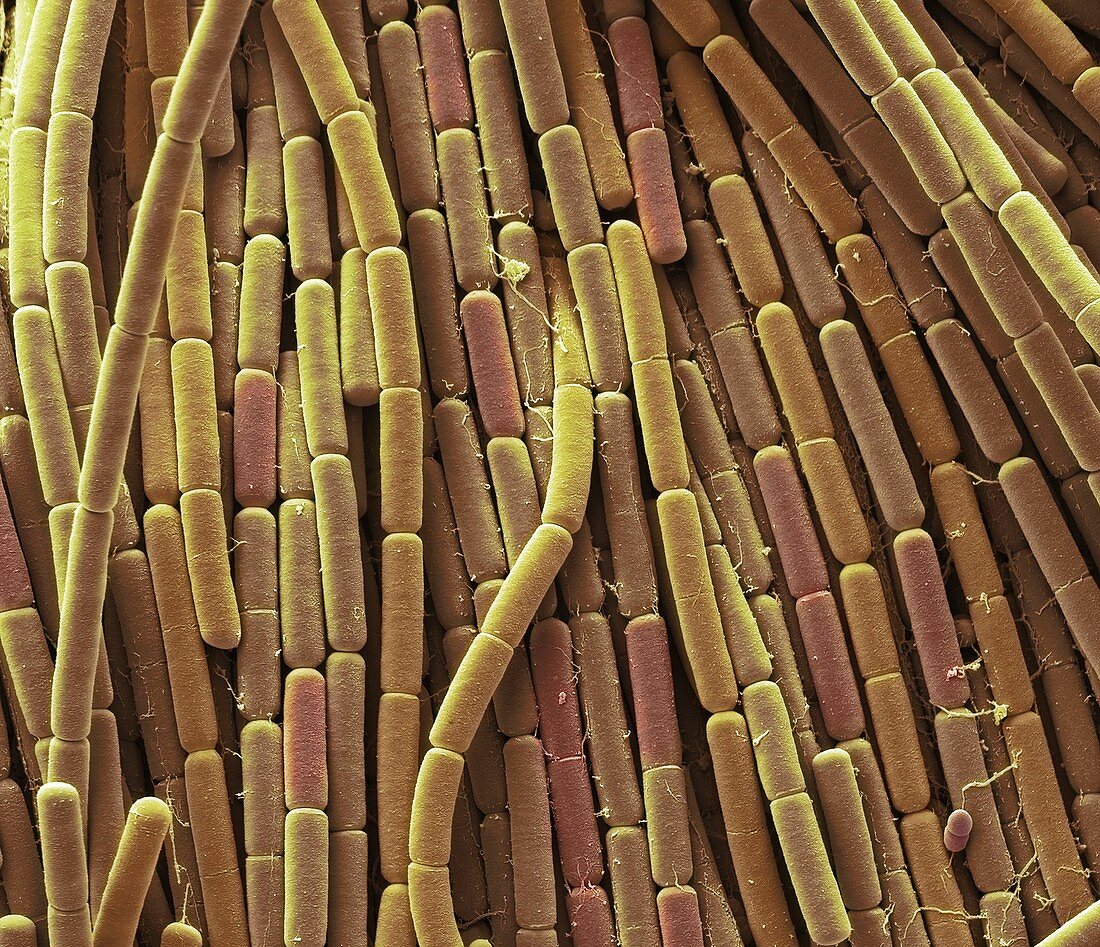 Clostridium villosum, SEM