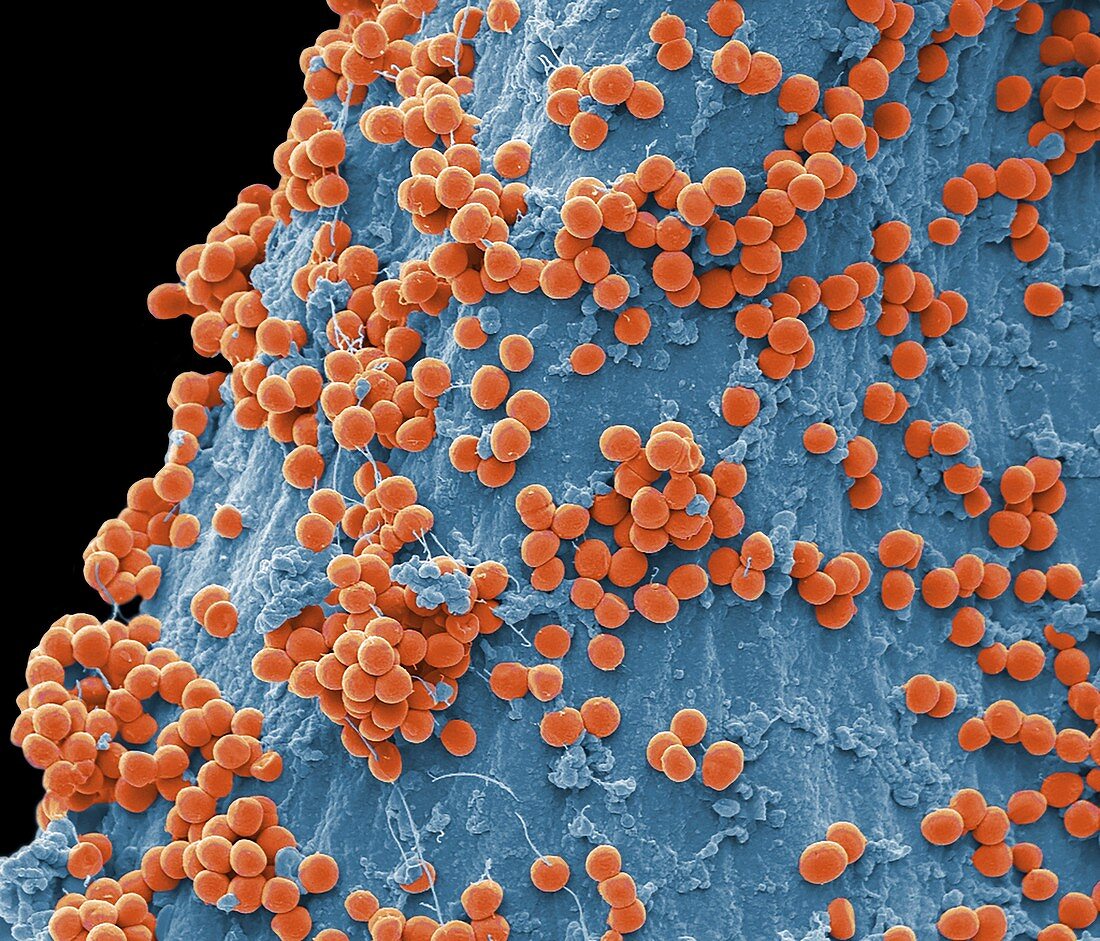 Streptococci bacteria, SEM