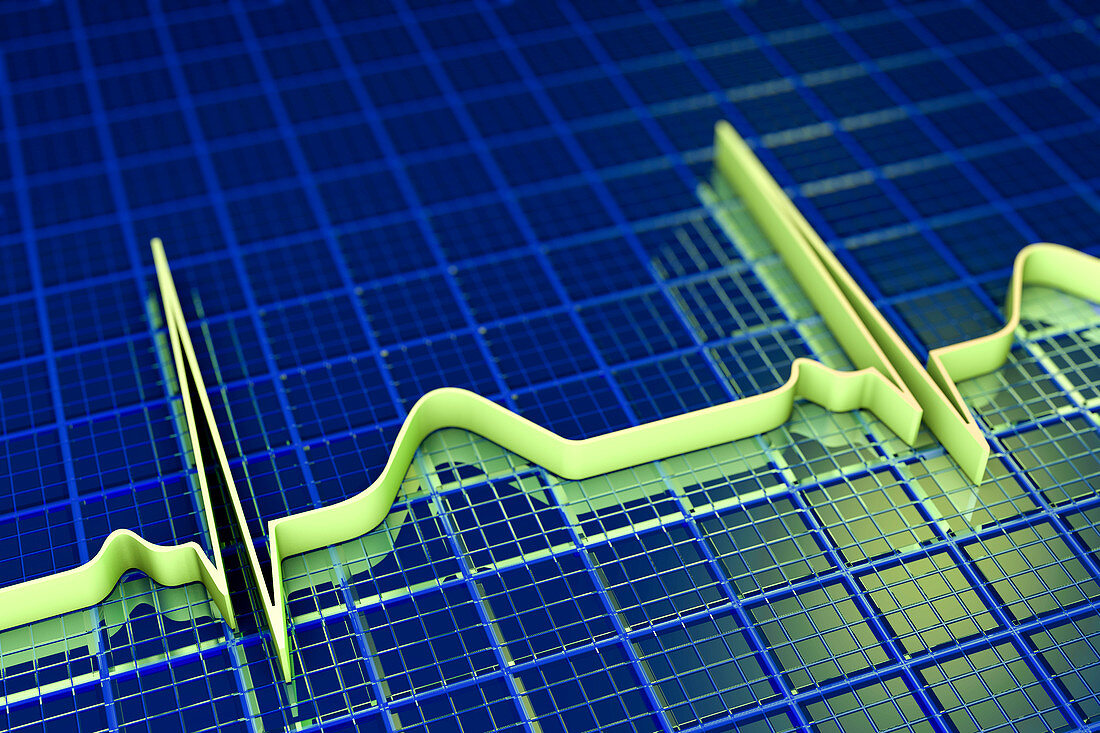 ECG, illustration