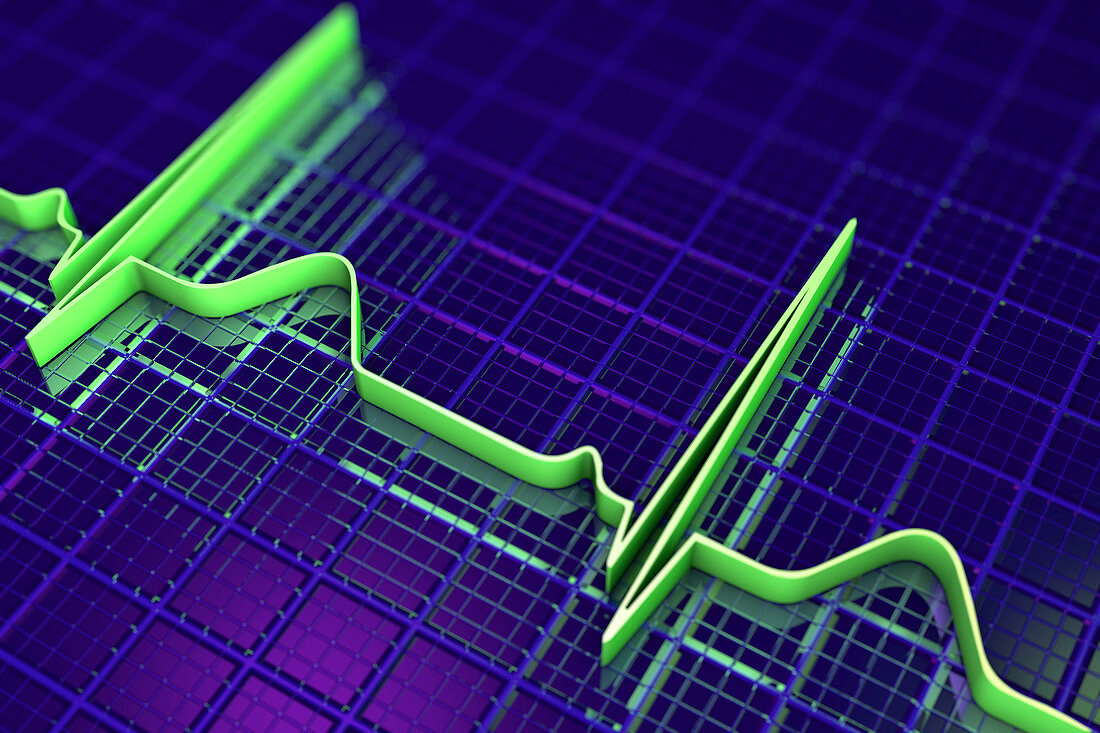 ECG, illustration