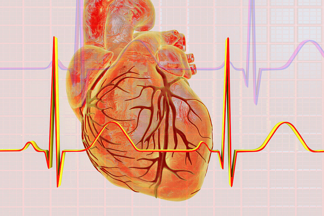Normal Heartbeat, illustration