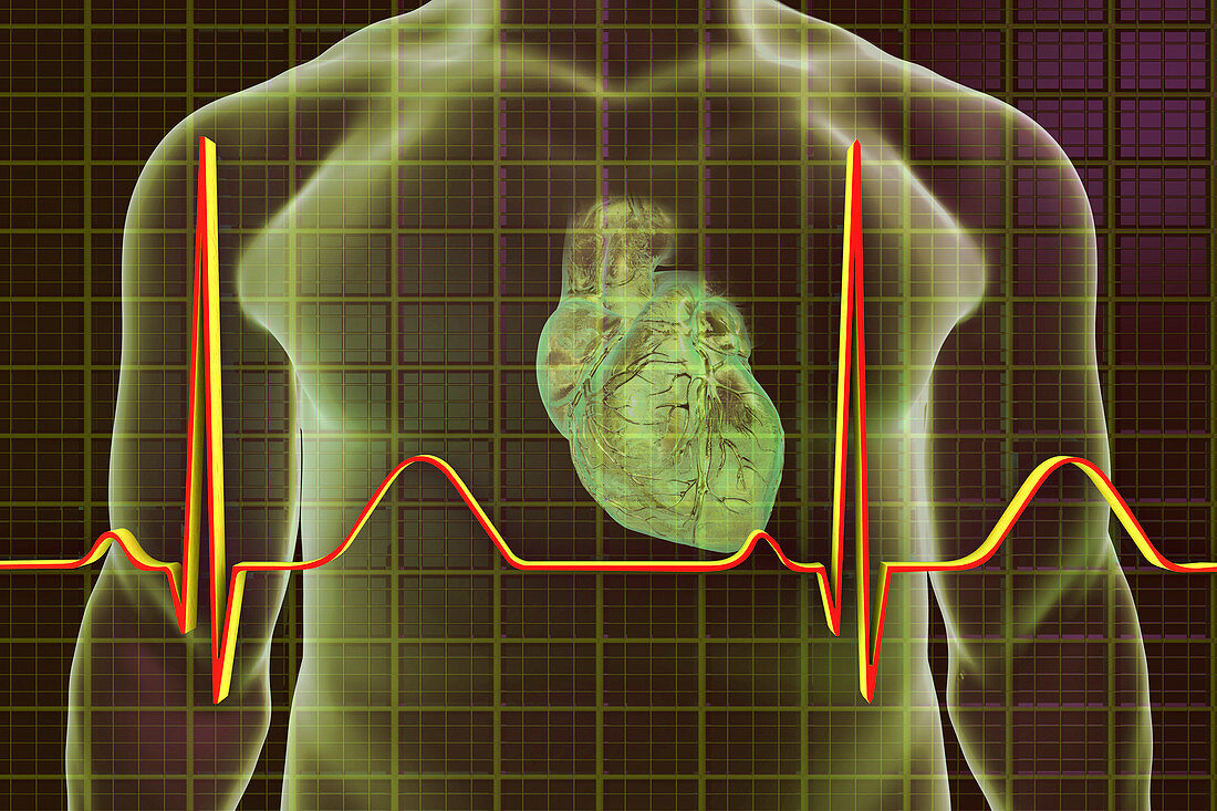 Normal Heartbeat, illustration