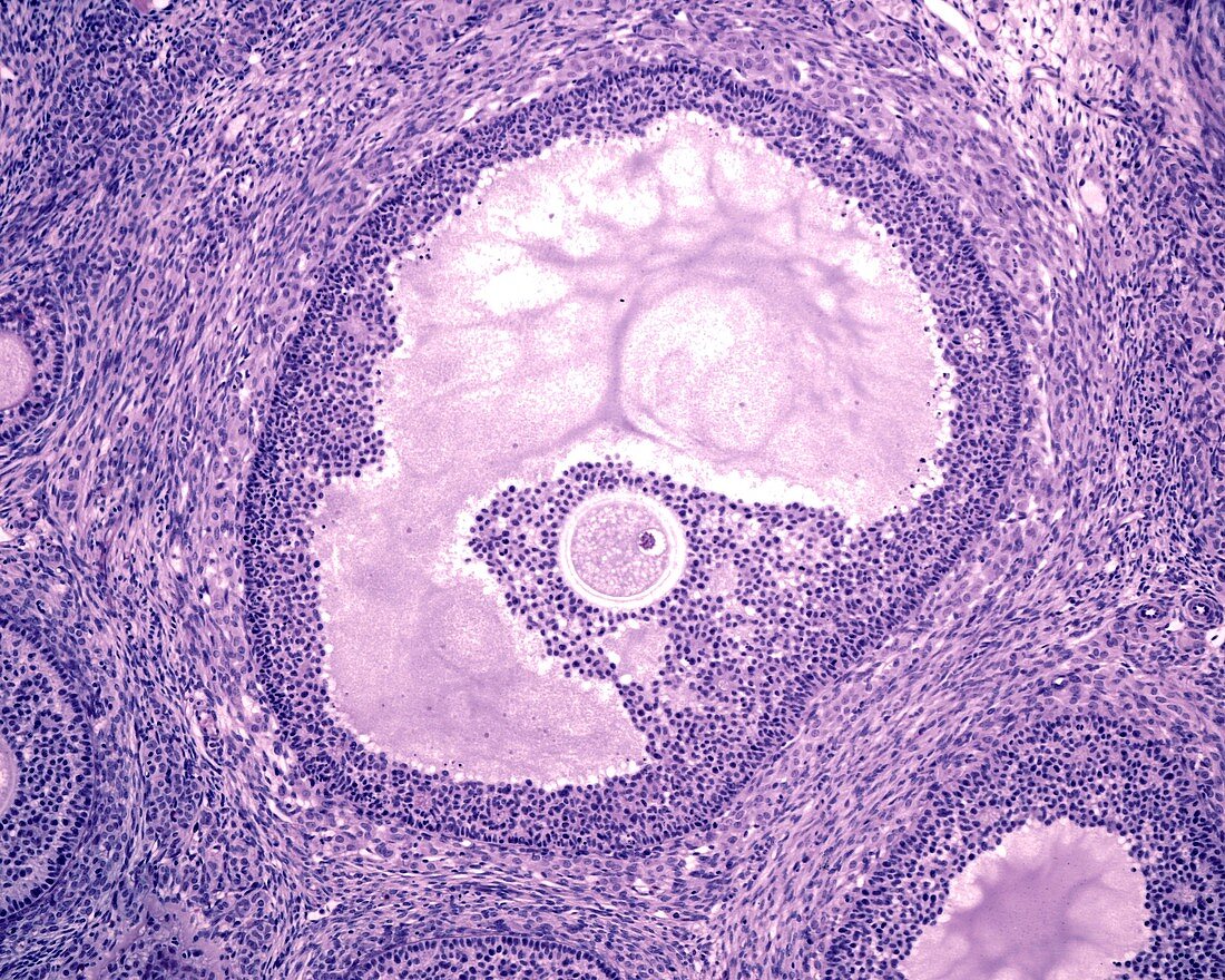 Ovarian Graafian follicle,light micrograph