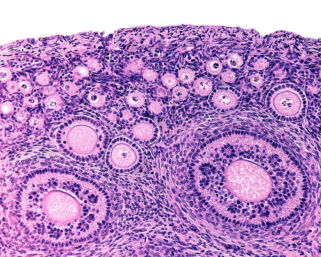Follicle activation in ovary,light micrograph