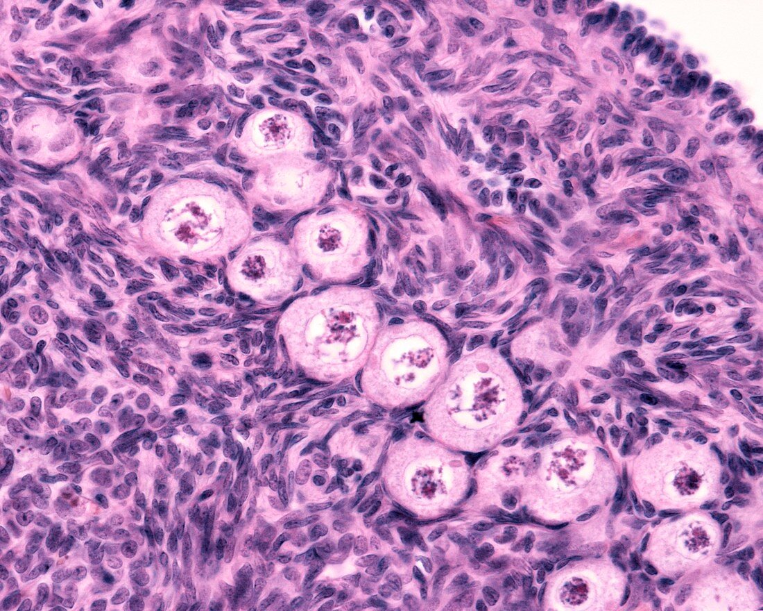 Ovarian primordial follicles,light micrograph