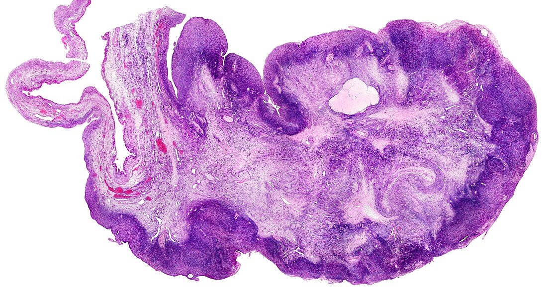 Menopausal human ovary,light micrograph