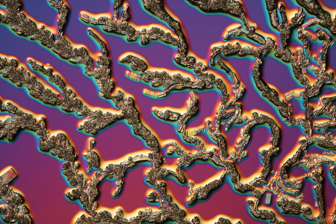Creatine crystals,light micrograph