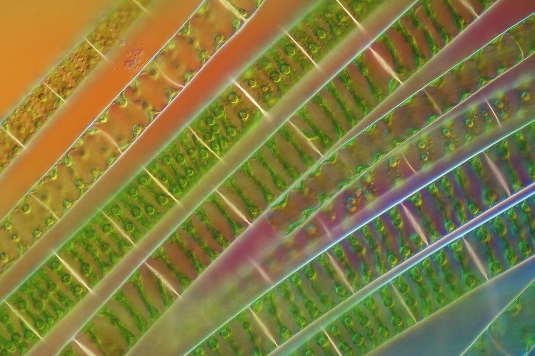 Algal strands,light micrograph