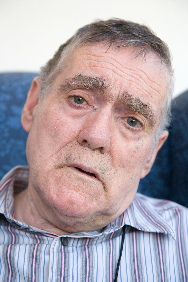 Portrait of a man with Alzheimer's Disease looking worried