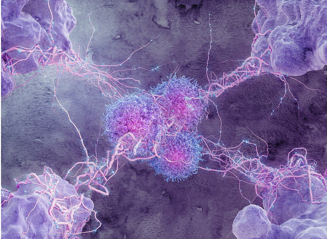 Cancer cells,illustration