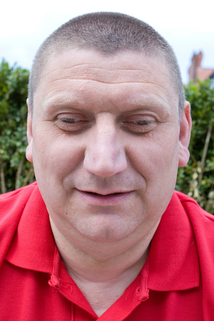 Portrait of a vision impaired man