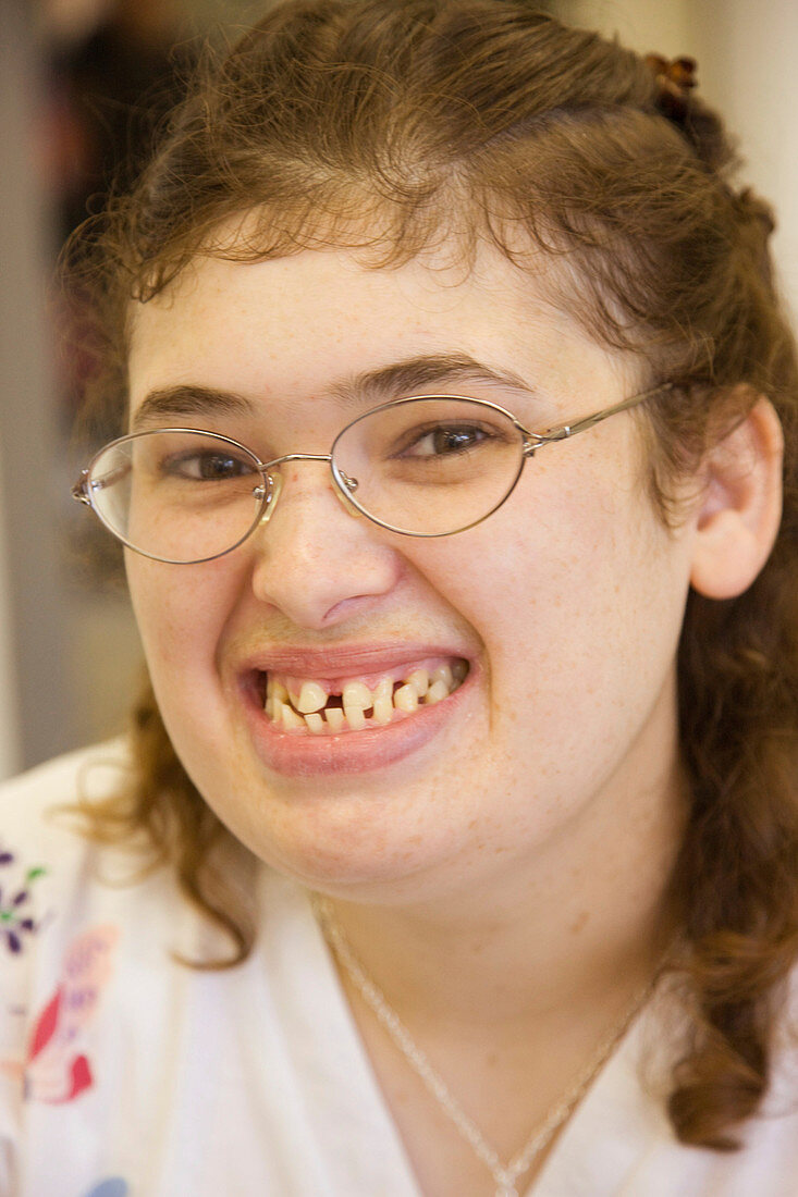 Portrait of a young woman with learning disability