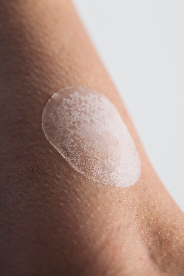 Close-up of upper arm with hormone replacement patch