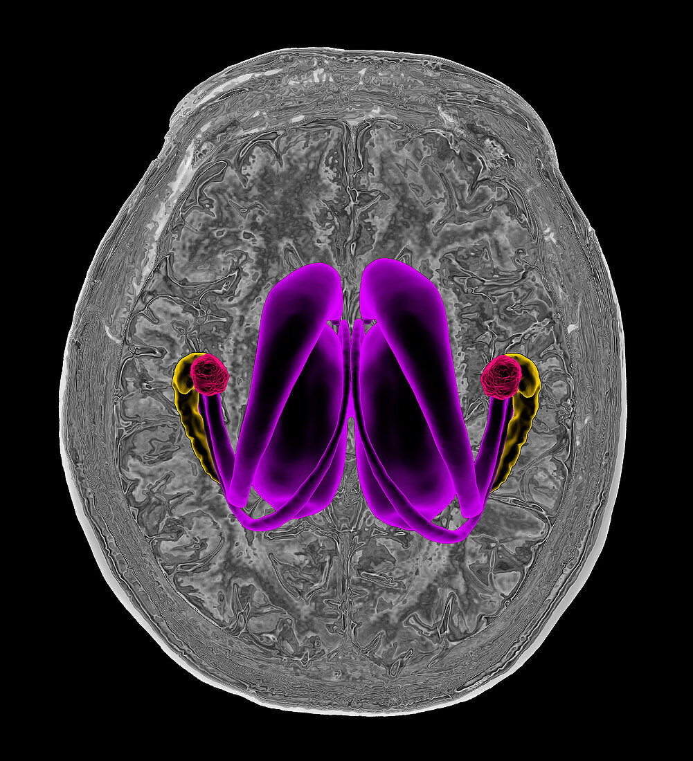 Human brain and limbic system,MRI-based illustration