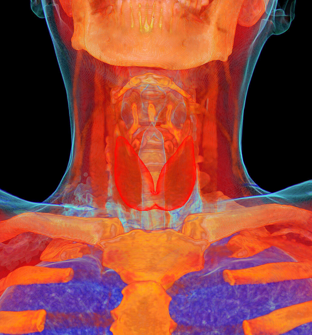 Human neck anatomy,3D CT scan