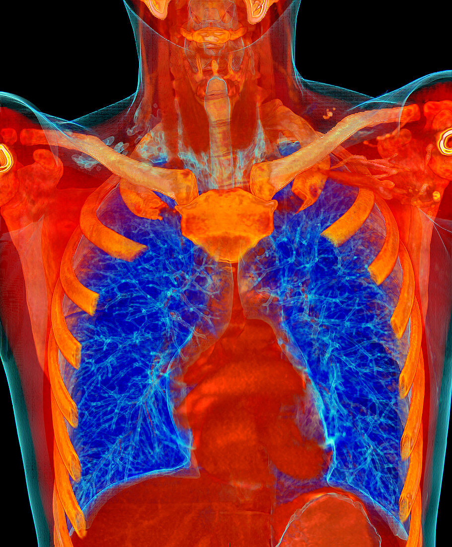 Human chest anatomy,3D CT scan