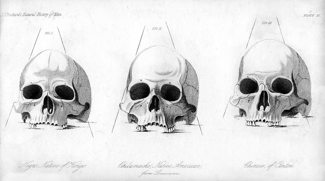 Three types of human skull, 1848