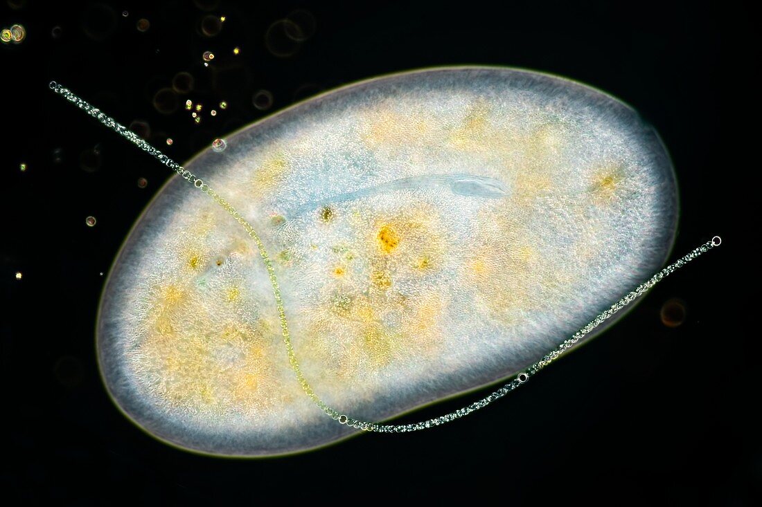 Frontonia sp. protist eats algae, light micrograph