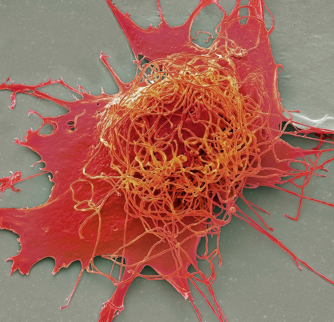 Liver cancer cell, SEM