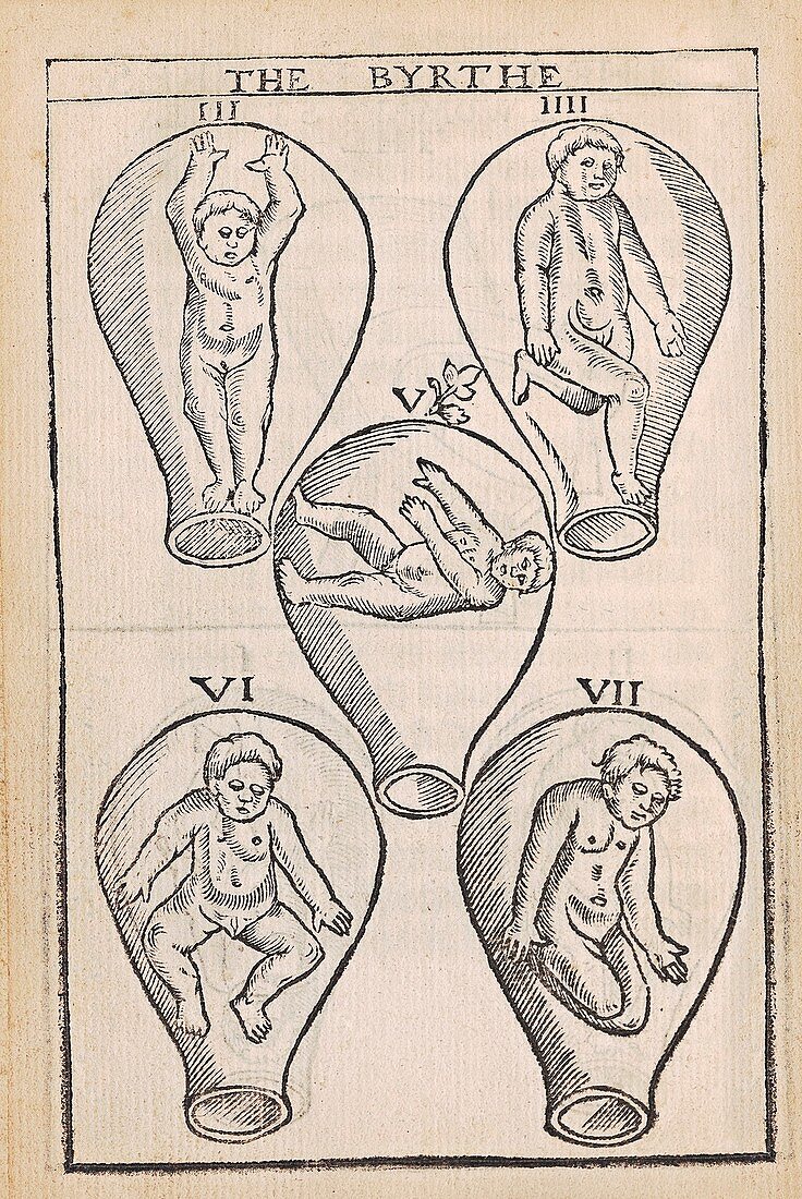 Foetal childbirth positions, 16th century