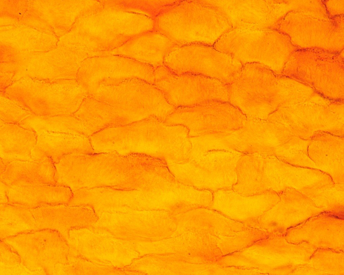 Skin epidermis, light micrograph