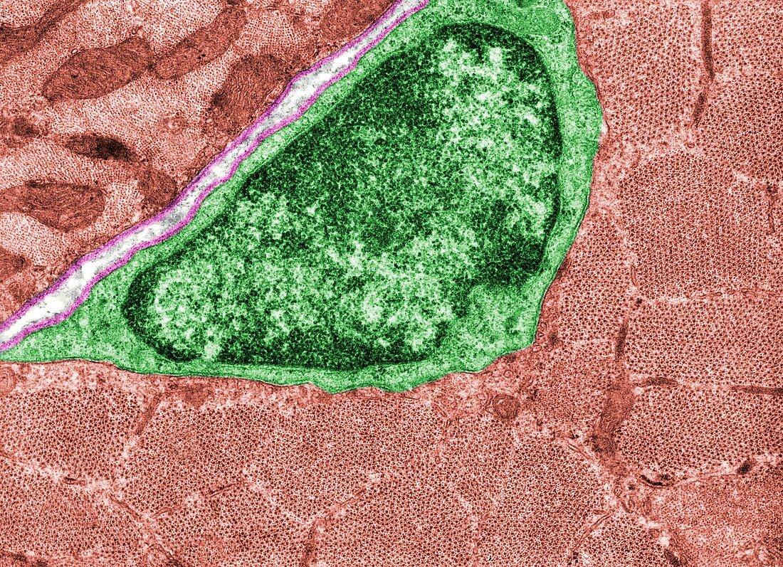 Muscle satellite cell, TEM