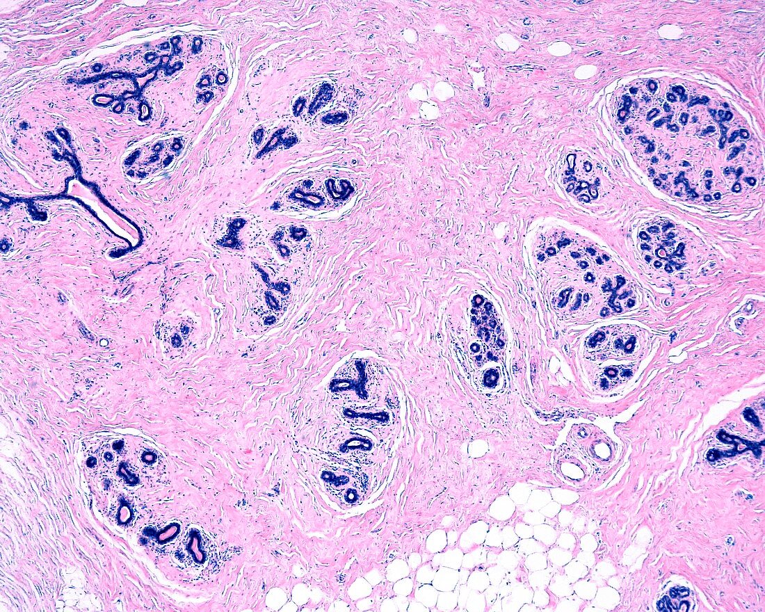 Human breast secretory units, light micrograph