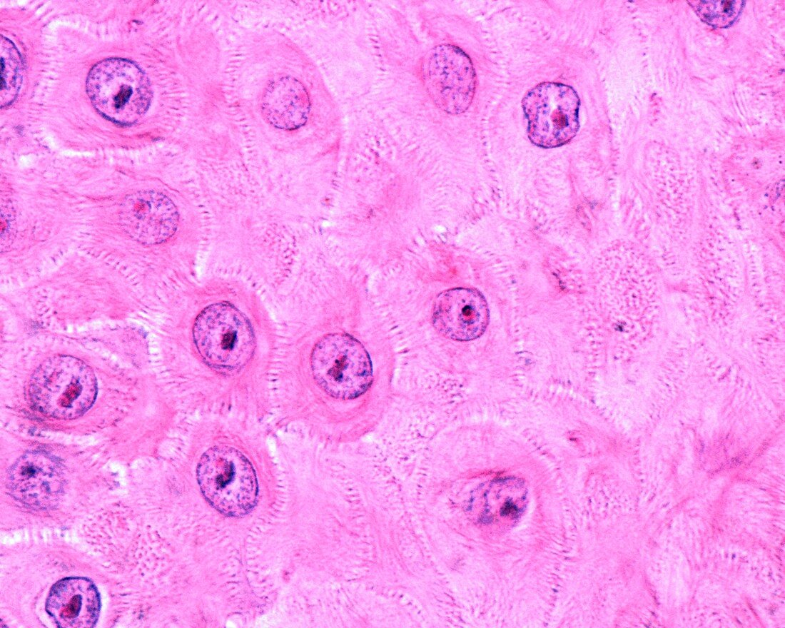 Spinous layer of epidermis, light micrograph