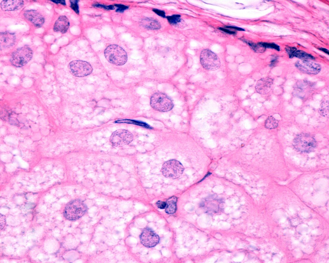 Sebaceous gland, light micrograph