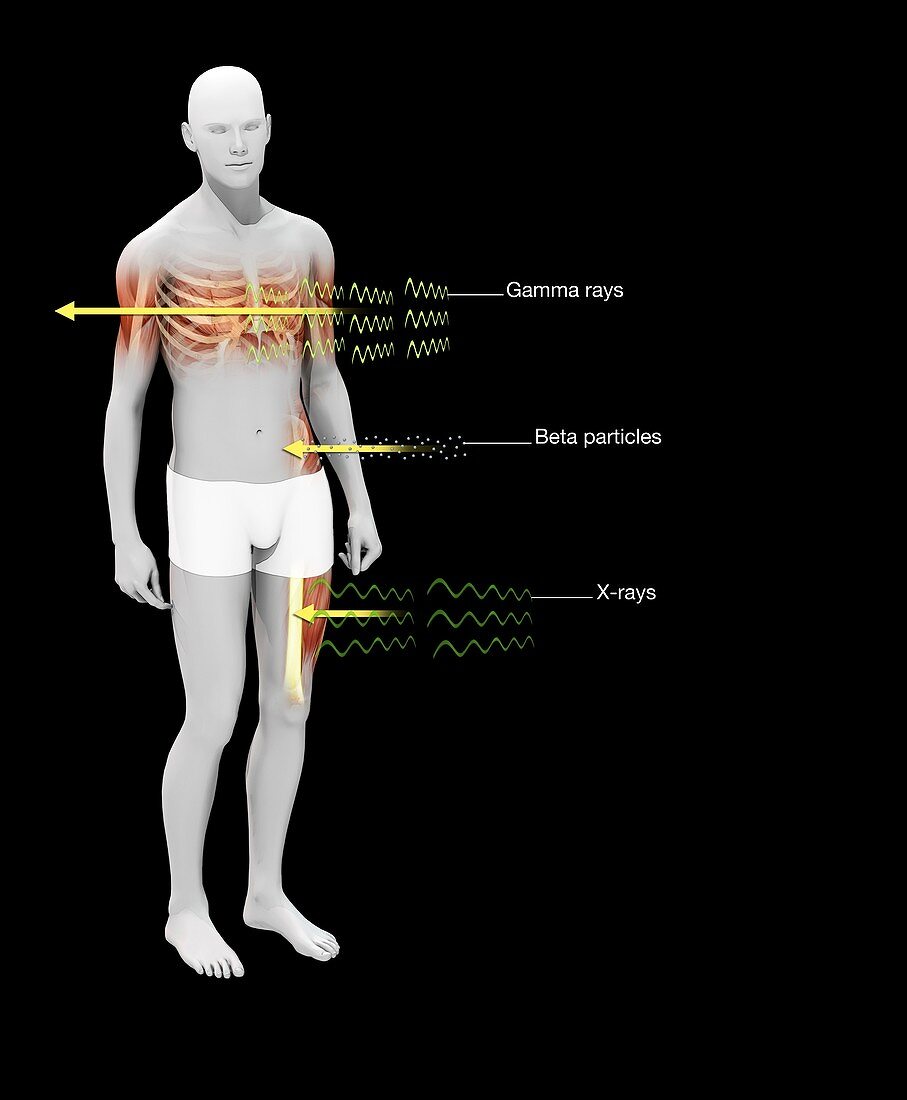 Radiation effects on humans, illustration