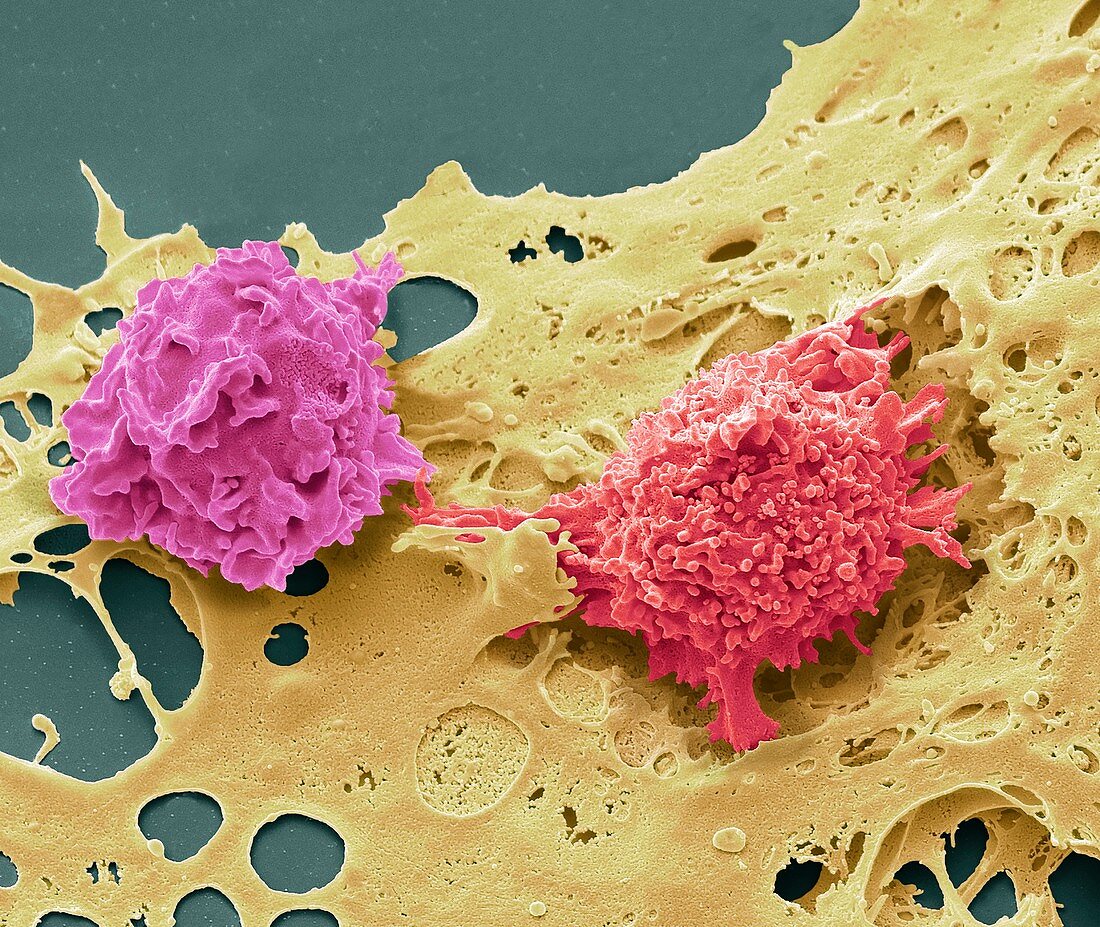 Natural killer cells and cancer cell, SEM