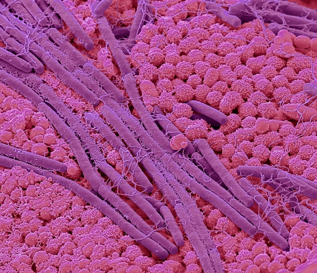 Tongue bacteria, SEM
