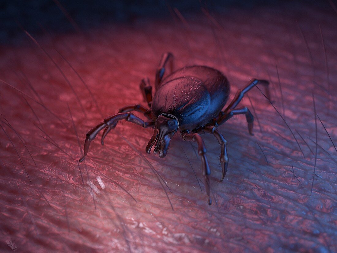 Illustration of a tick on skin