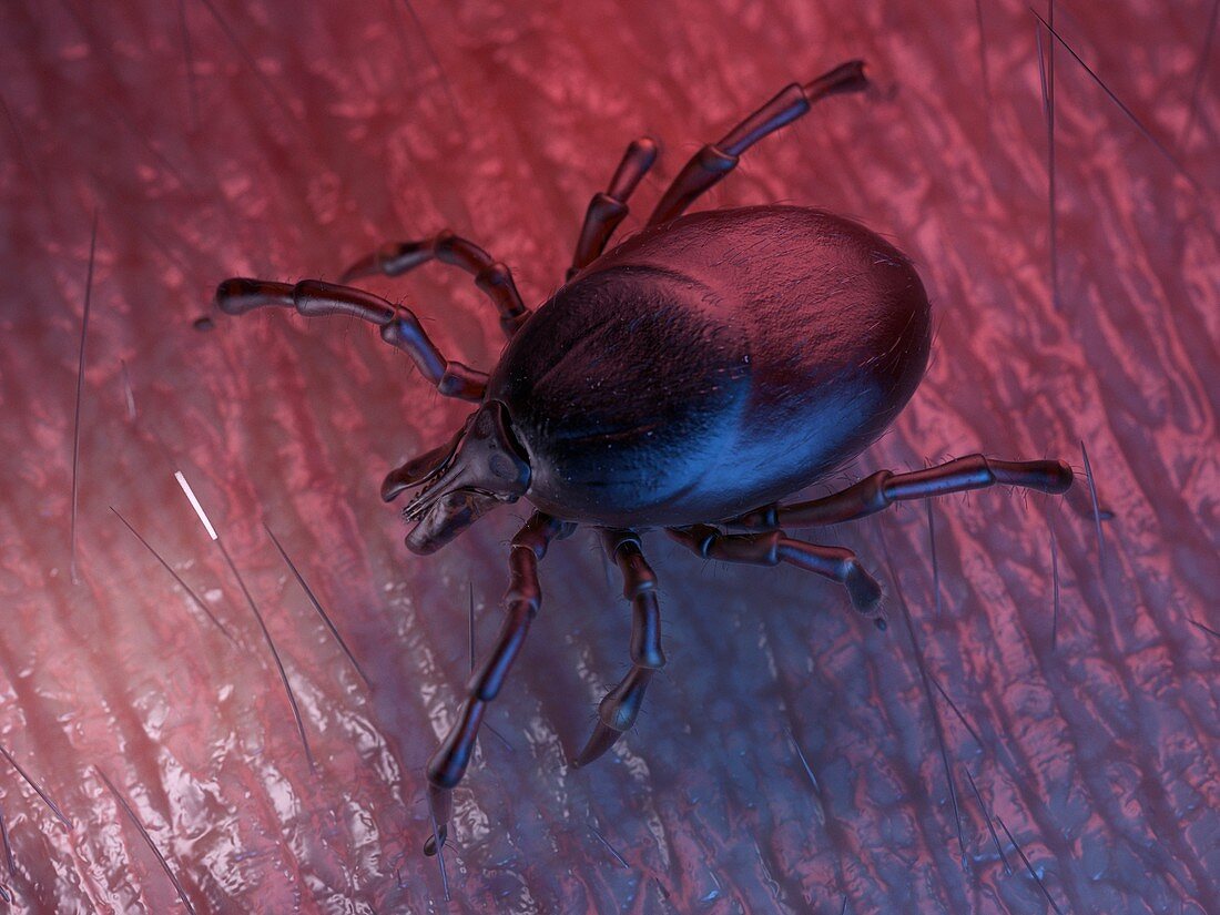 Illustration of a tick on skin