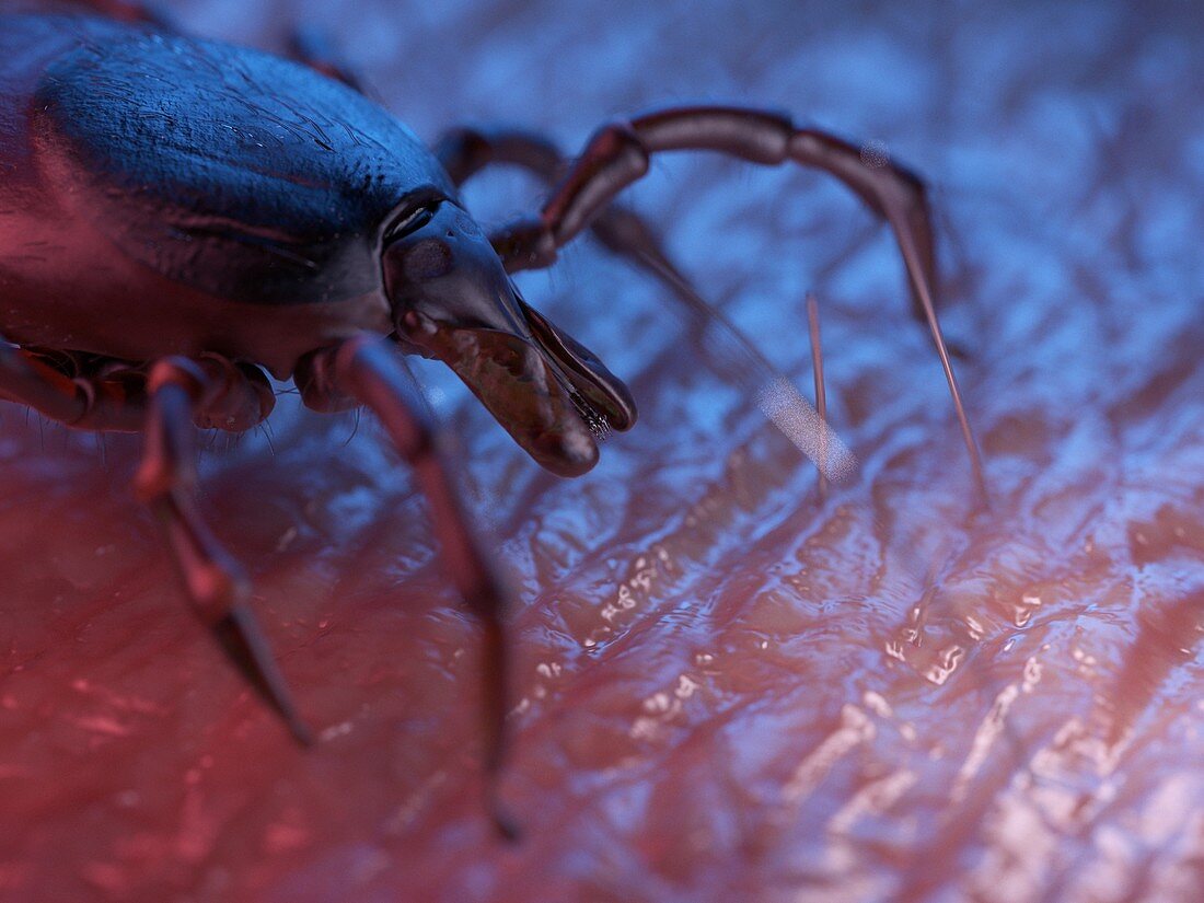 Illustration of a tick on skin