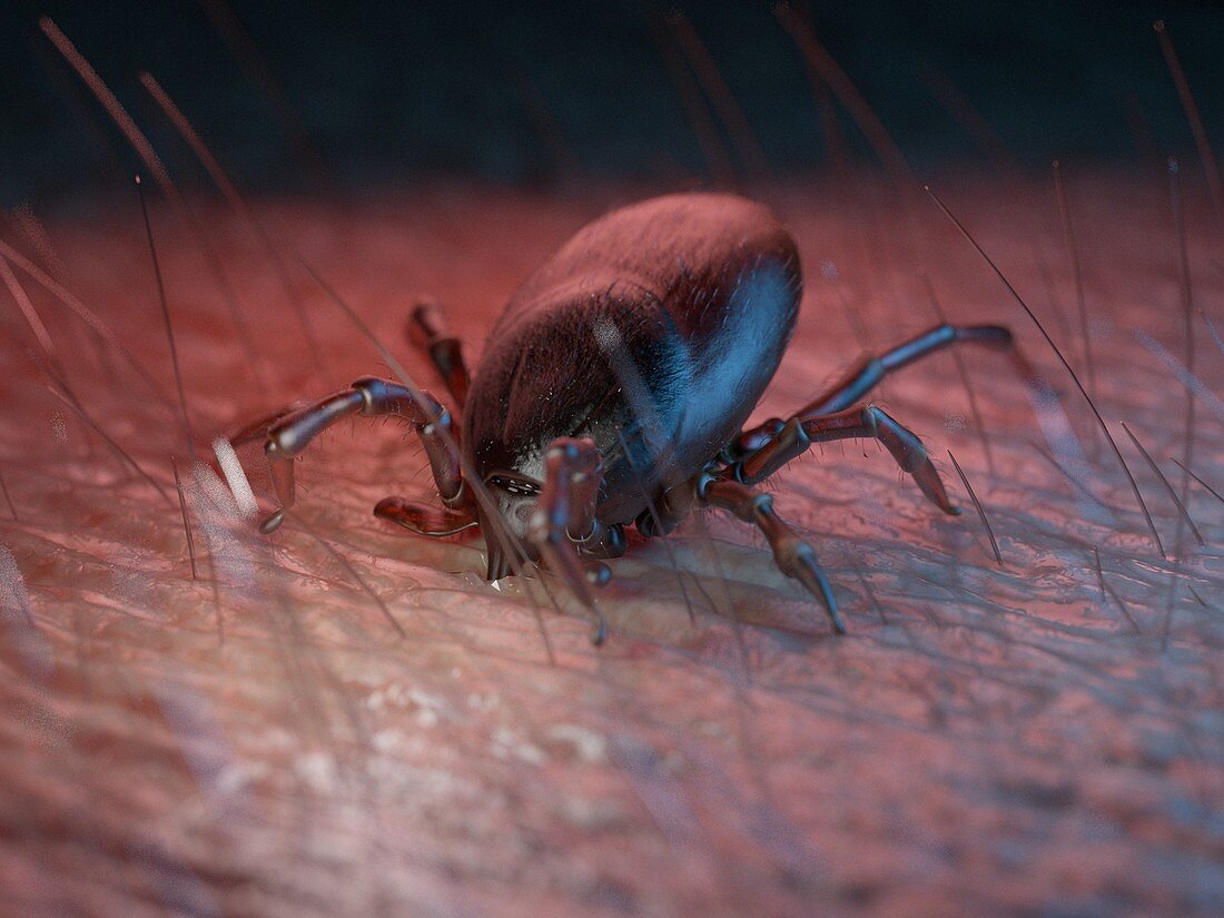 Illustration of a tick on human skin