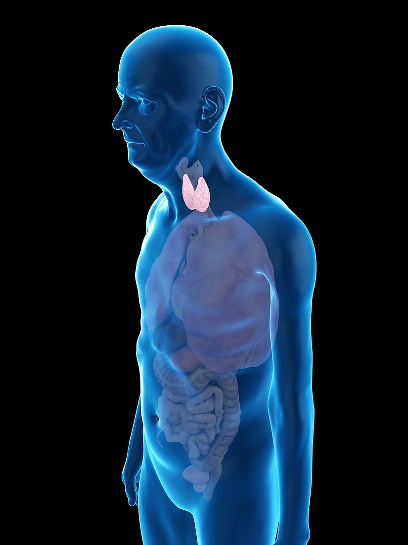 Illustration of an old man's thyroid