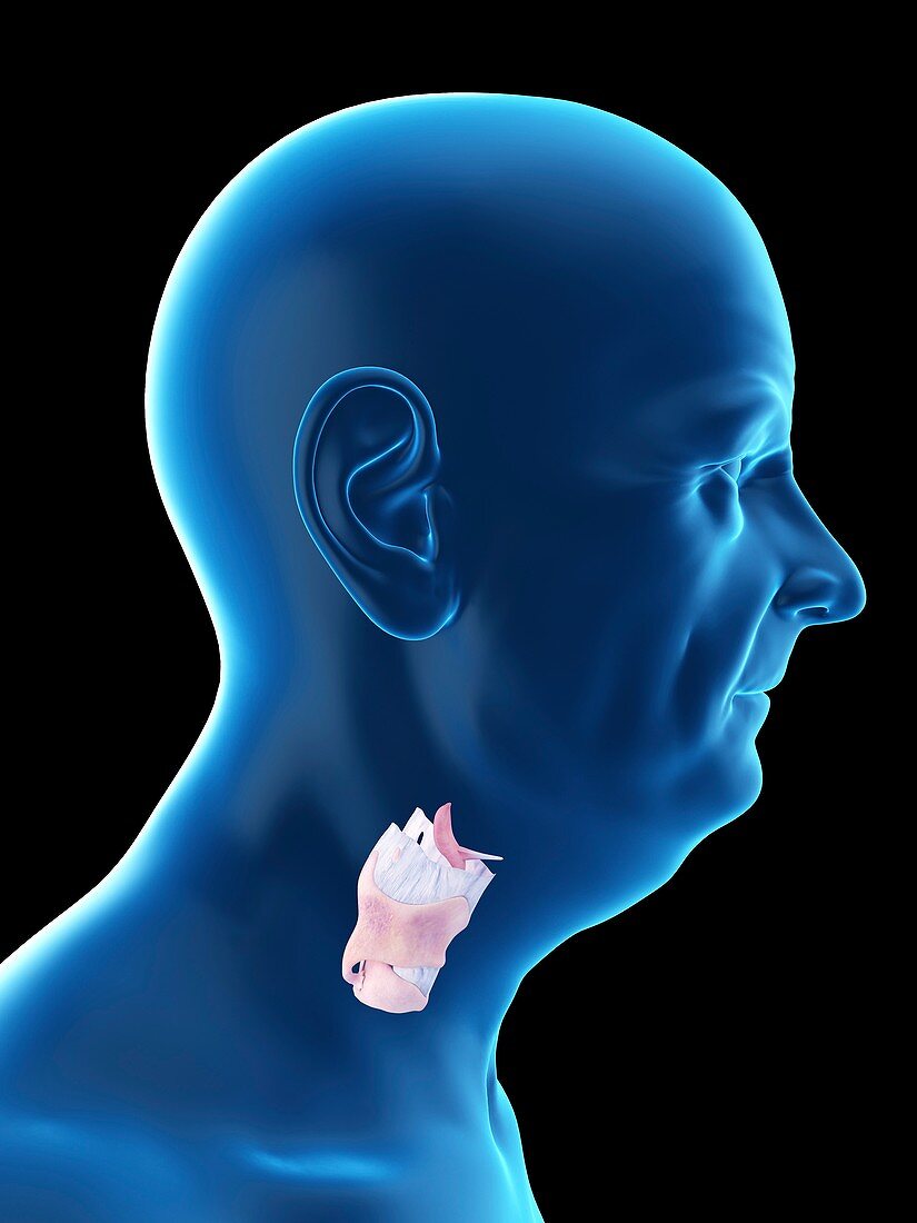 Illustration of an old man's larynx