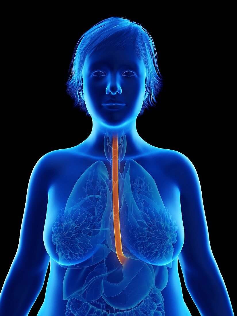 Illustration of an obese woman's esophagus