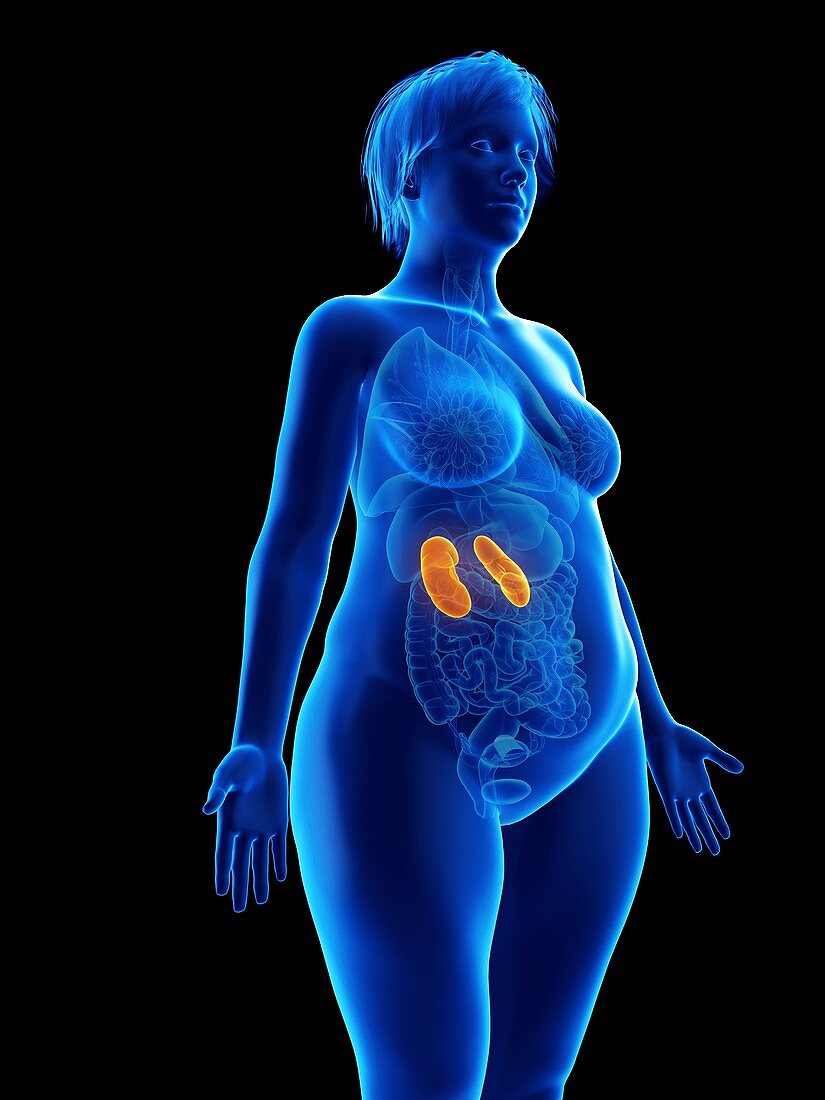 Illustration of an obese woman's kidneys