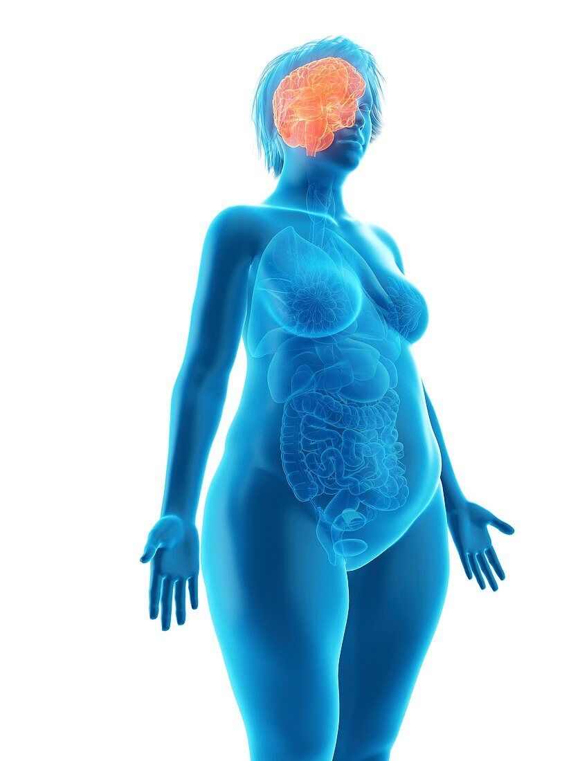 Illustration of an obese woman's brain