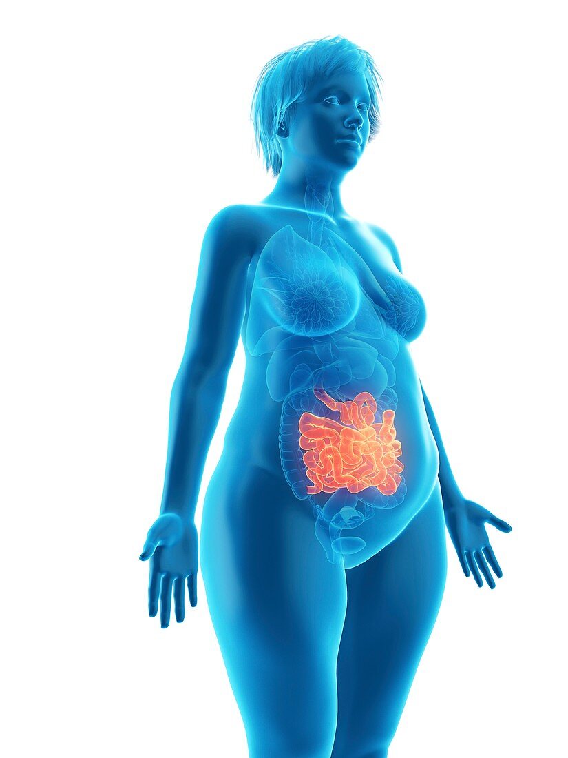 Illustration of an obese woman's small intestine