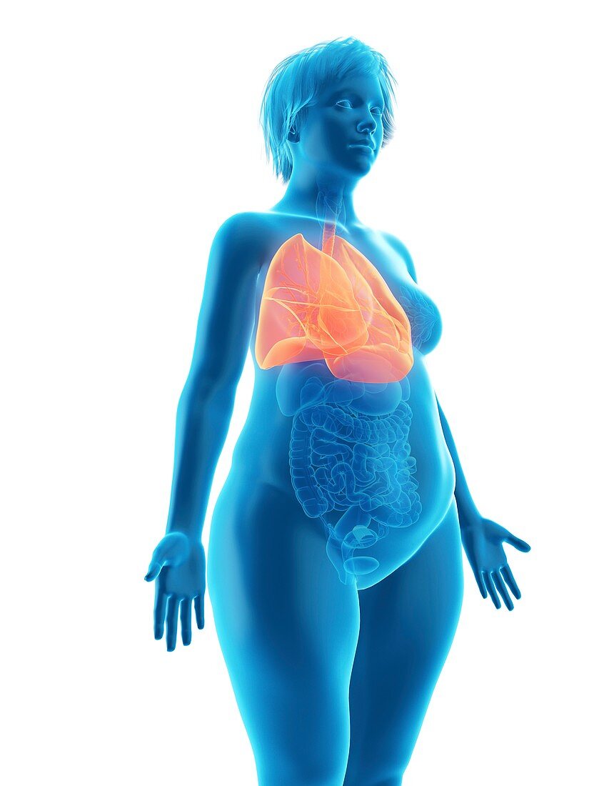 Illustration of an obese woman's lung