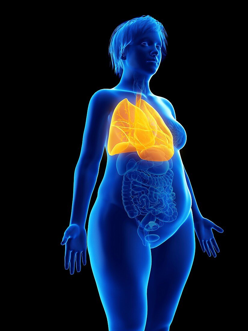 Illustration of an obese woman's lung