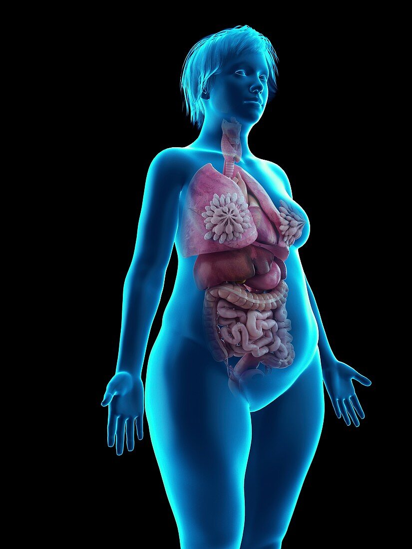 Illustration of an obese woman's internal organs