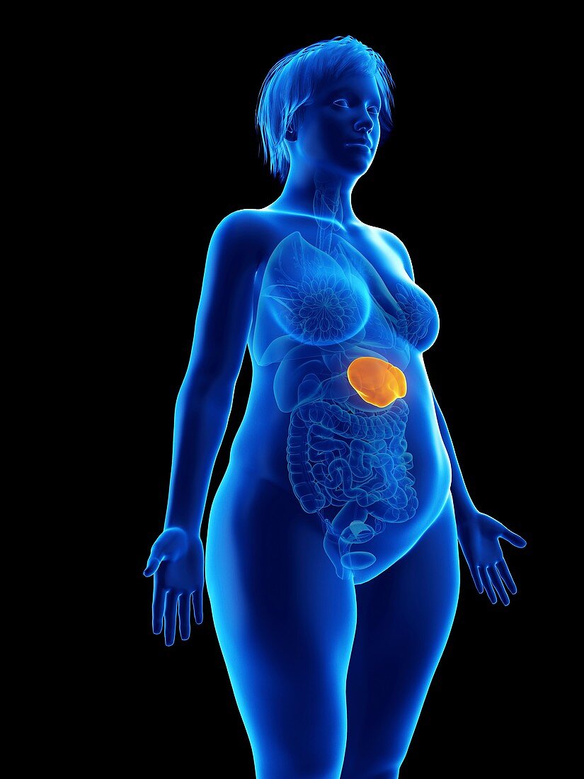 Illustration of an obese woman's spleen