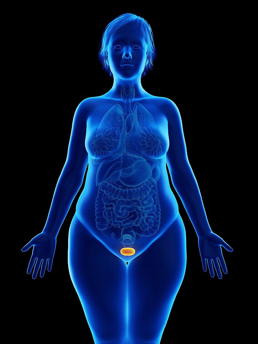 Illustration of an obese woman's bladder