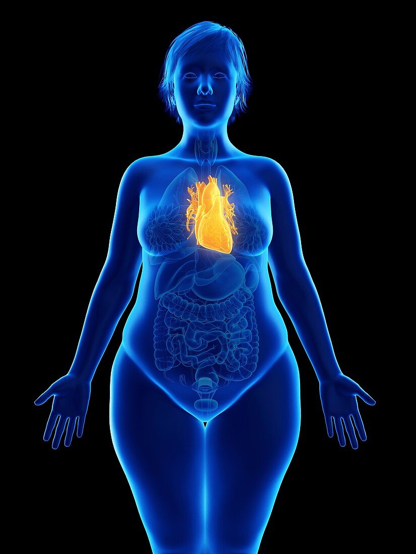 Illustration of an obese woman's heart