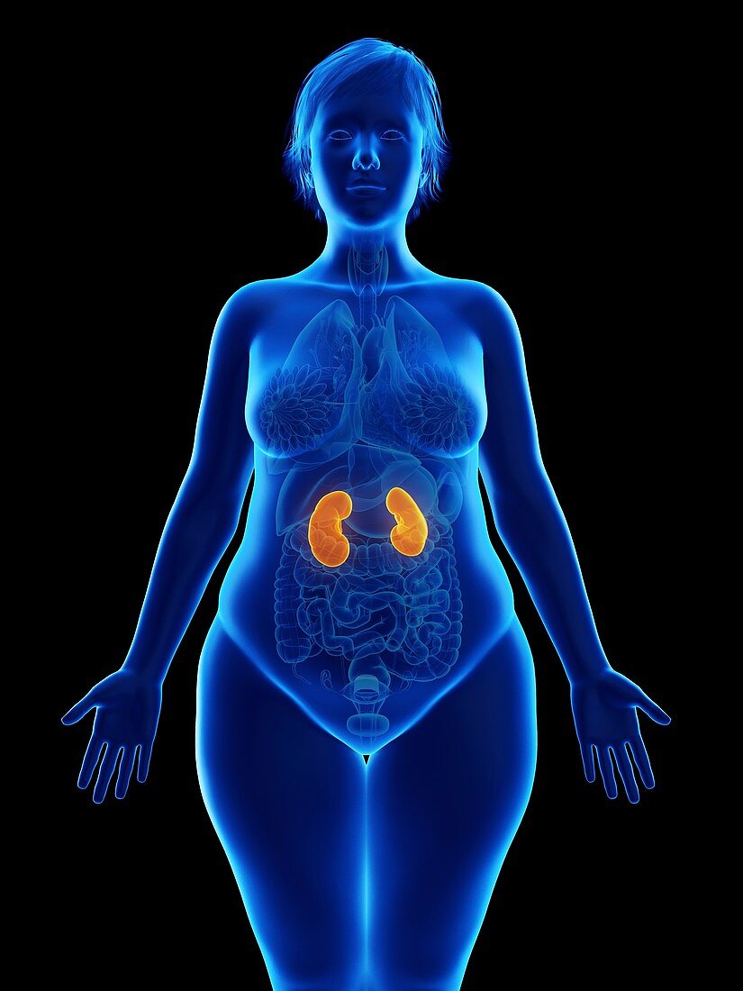 Illustration of an obese woman's kidneys